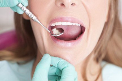 TMJ Disorder