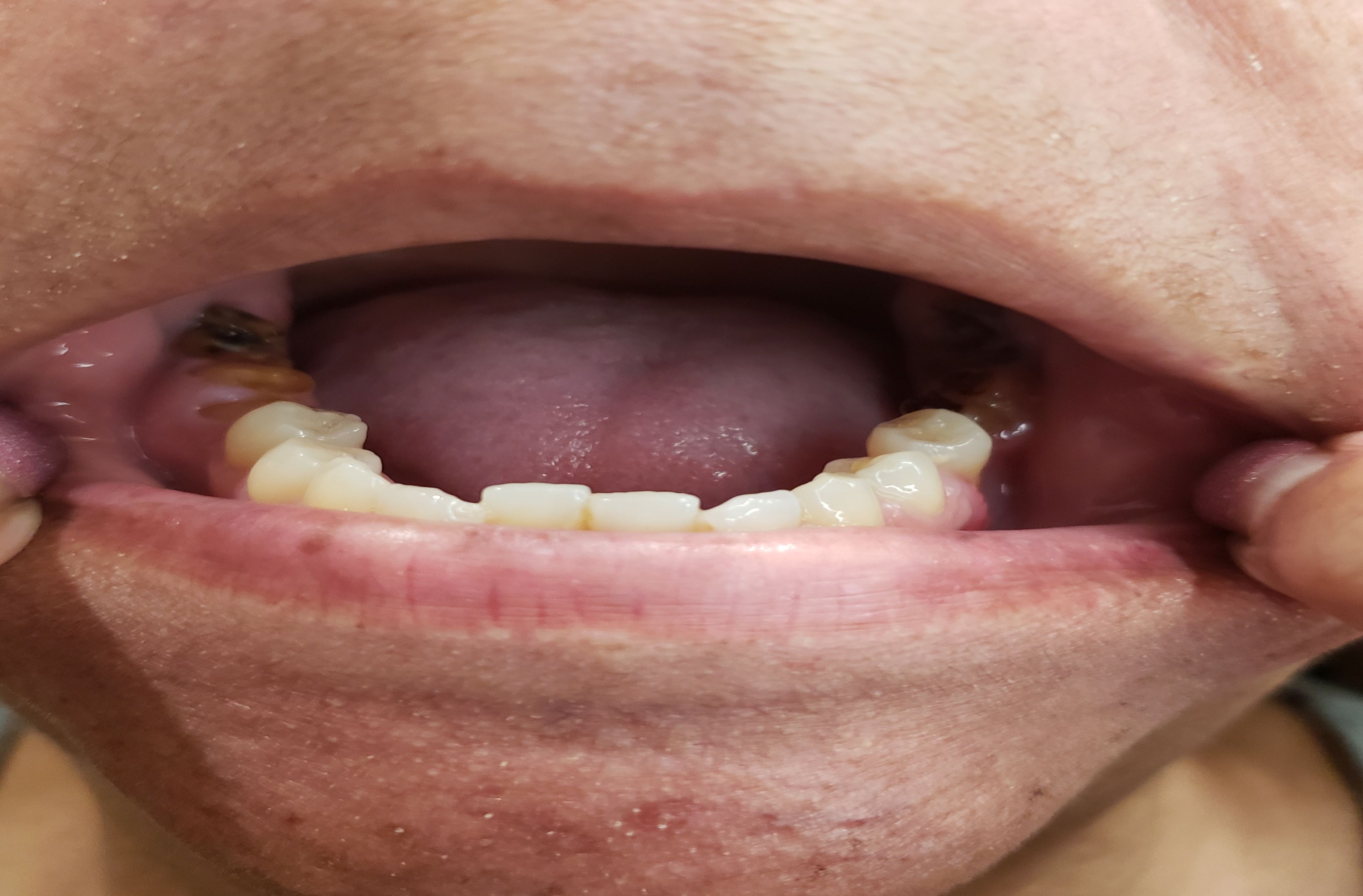 mouth lower arch