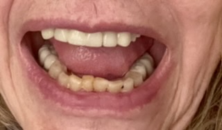 mouth open