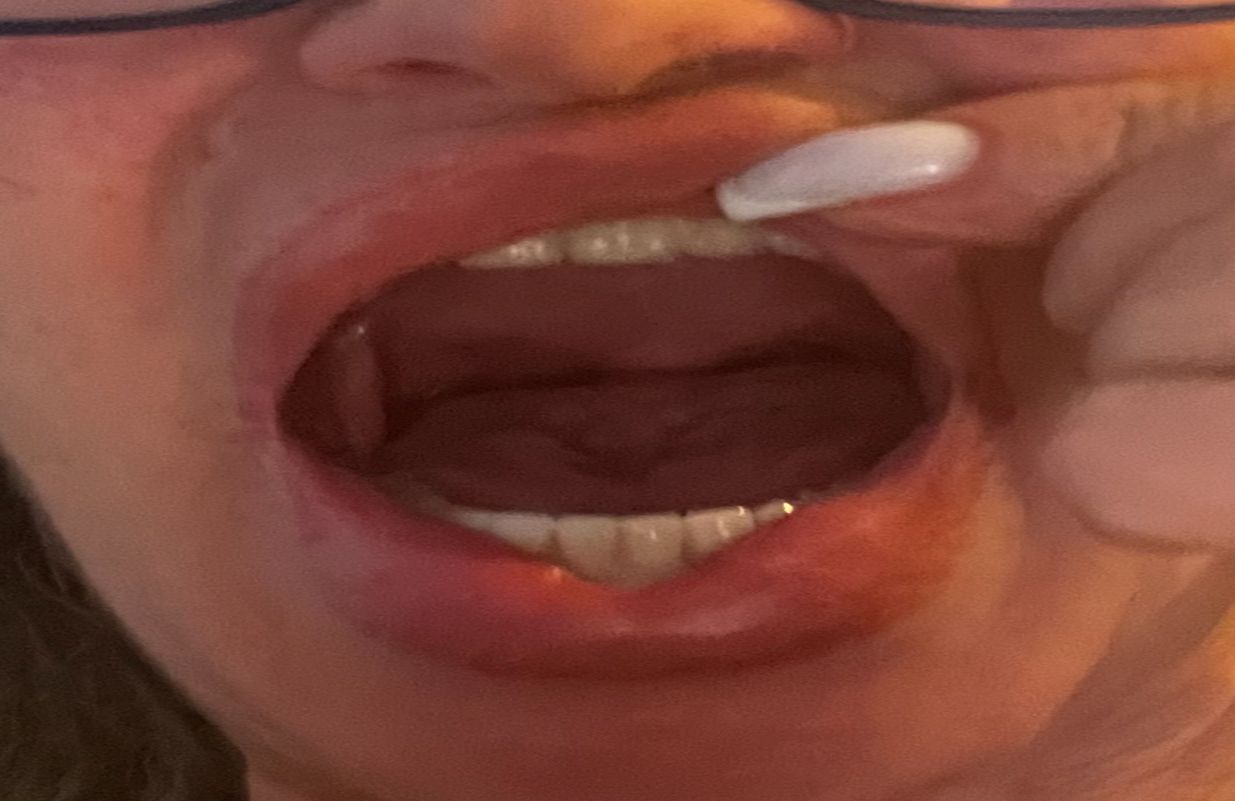 mouth open