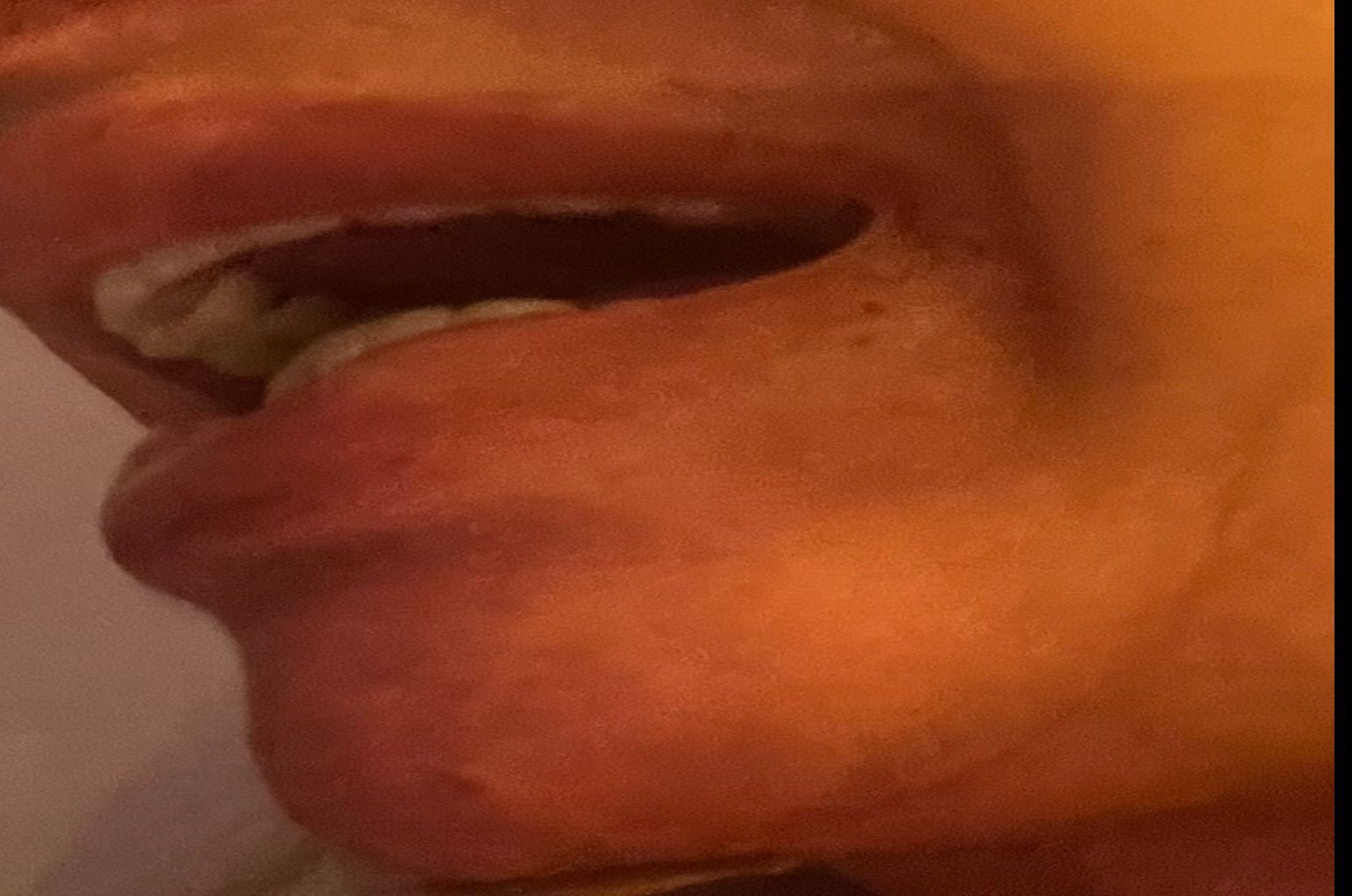 mouth left side