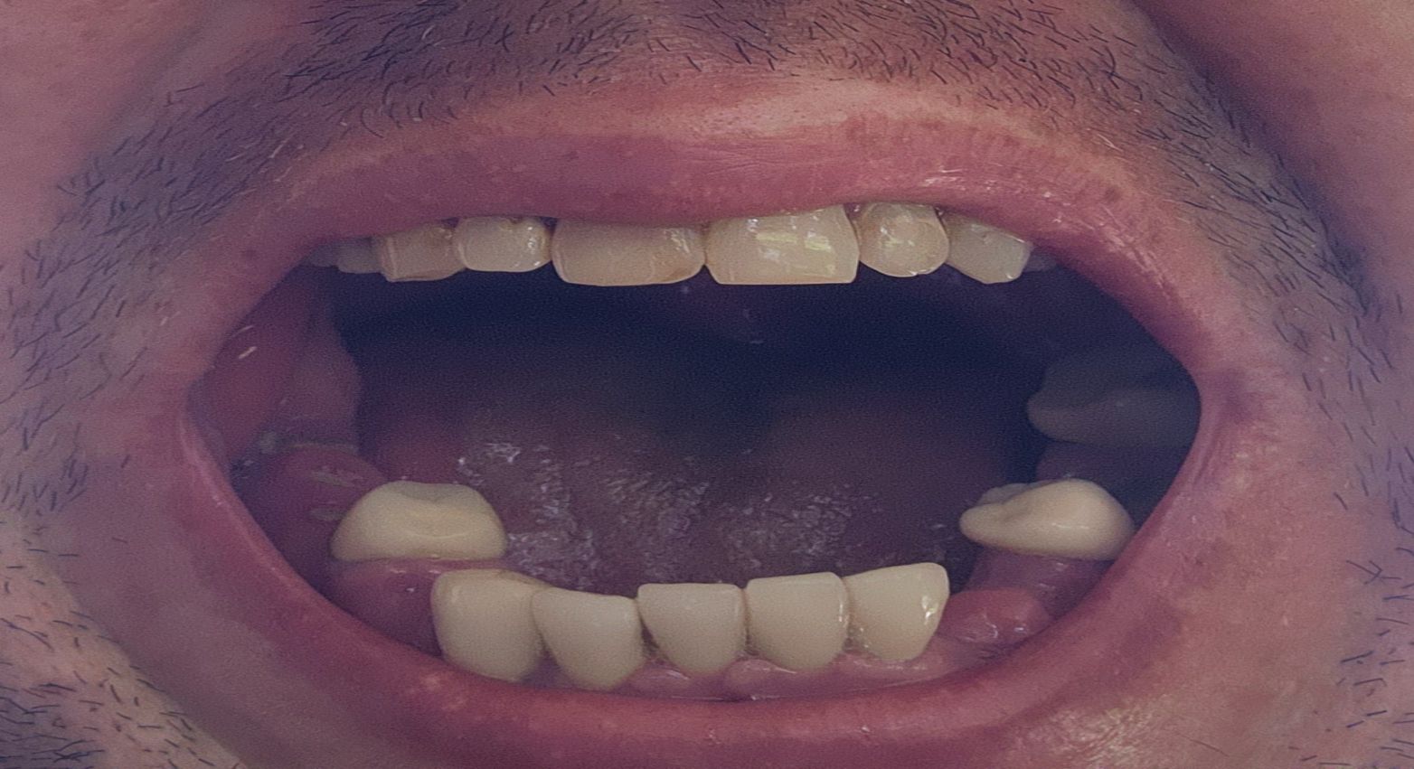 mouth open