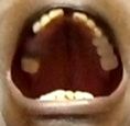 mouth upper arch mouth upper arch