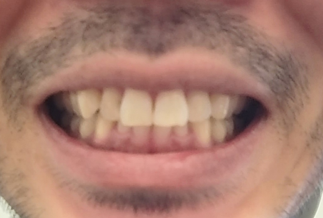 mouth closed mouth closed