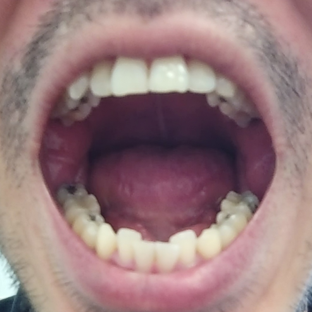 mouth open mouth open