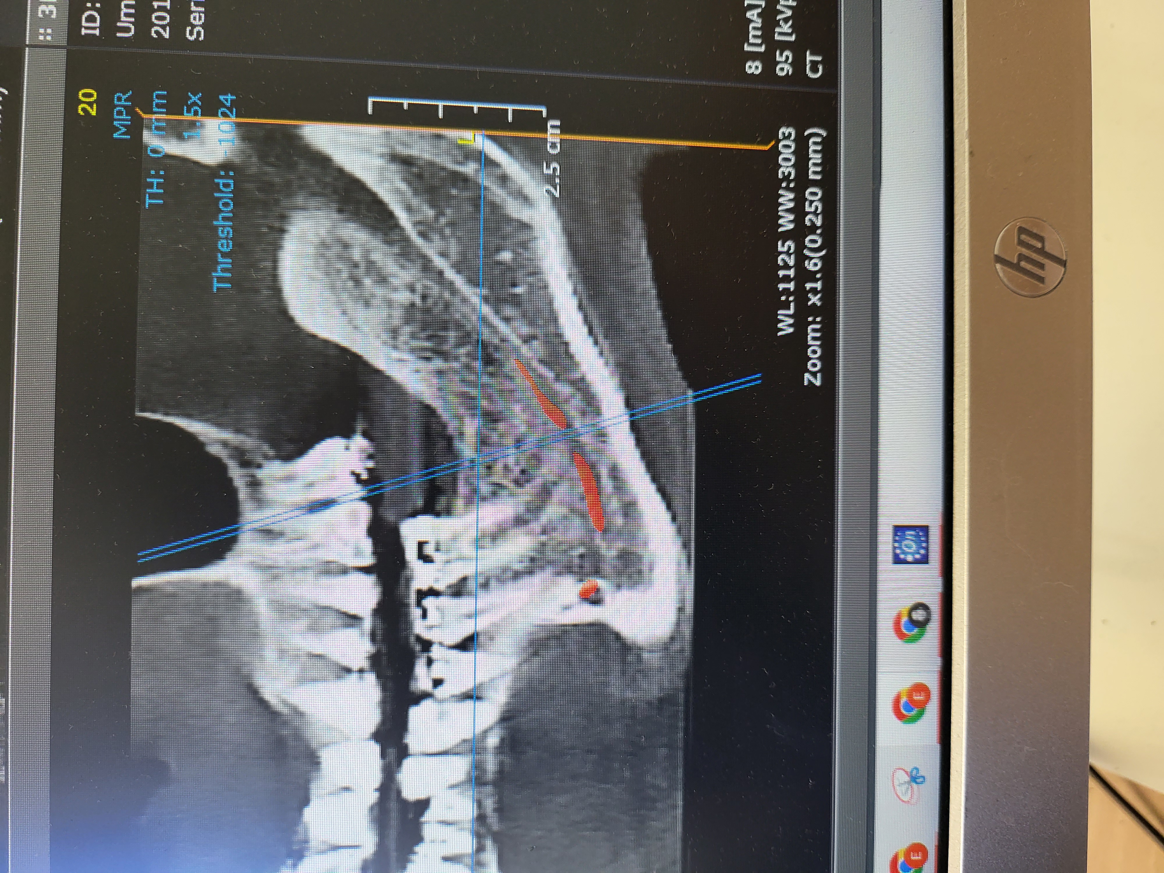 mouth more1 mouth more1