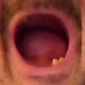 mouth open