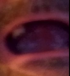 mouth upper arch mouth upper arch