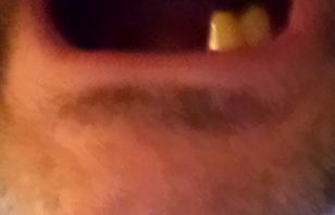 mouth lower arch mouth lower arch