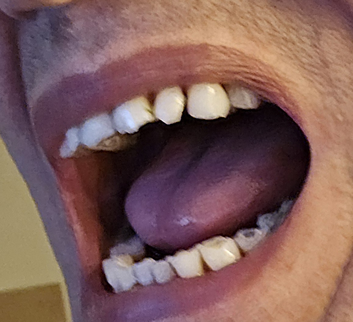 mouth right side