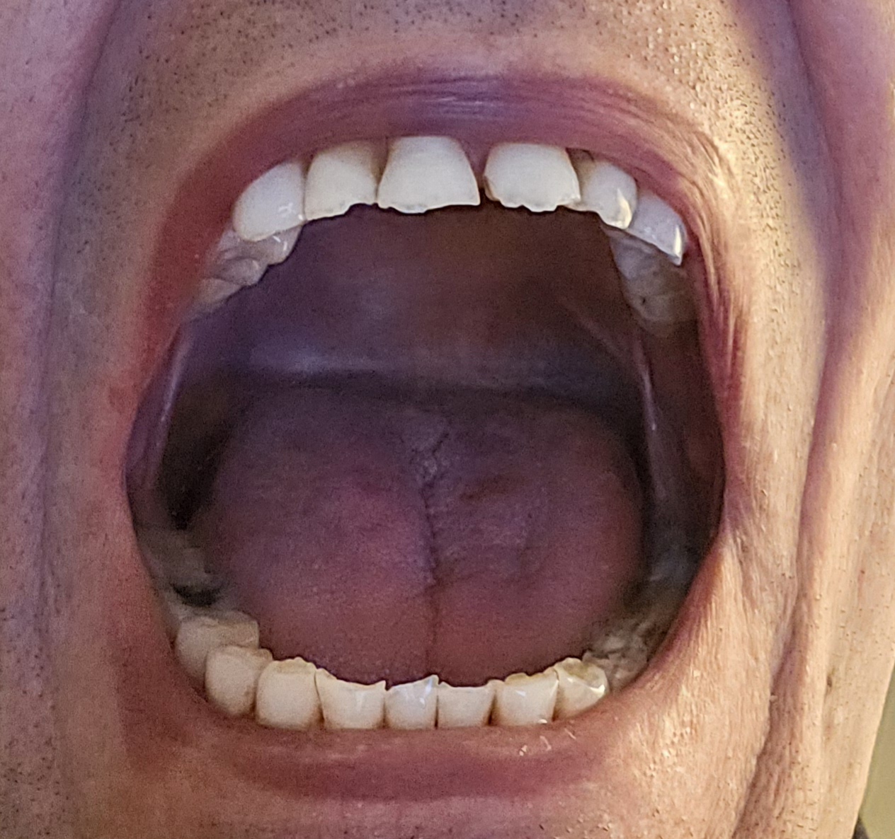 mouth more1
