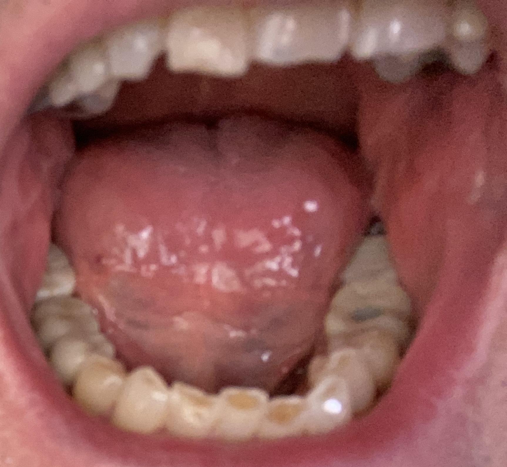 mouth lower arch
