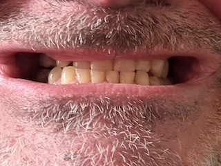 mouth closed