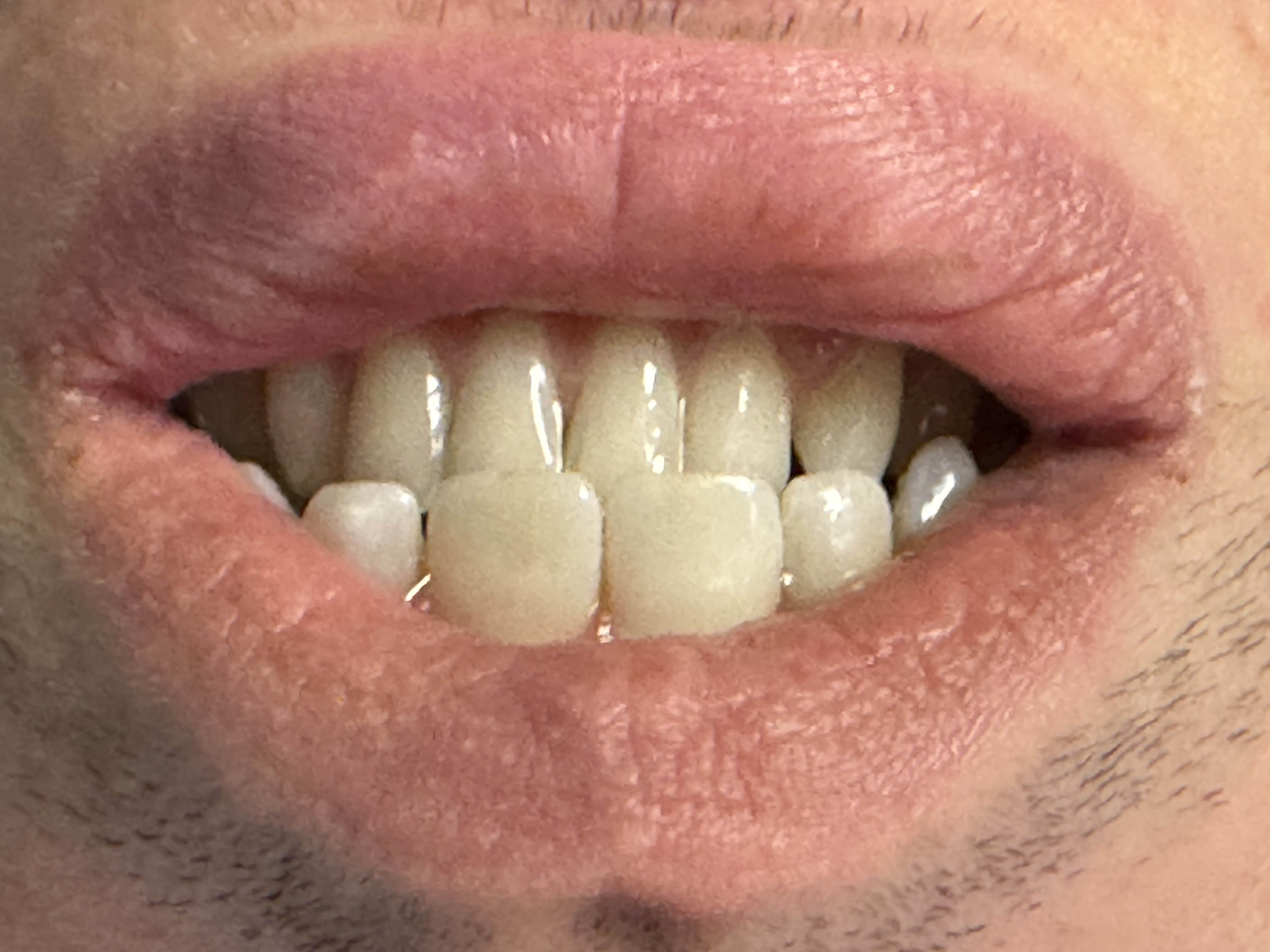 mouth closed