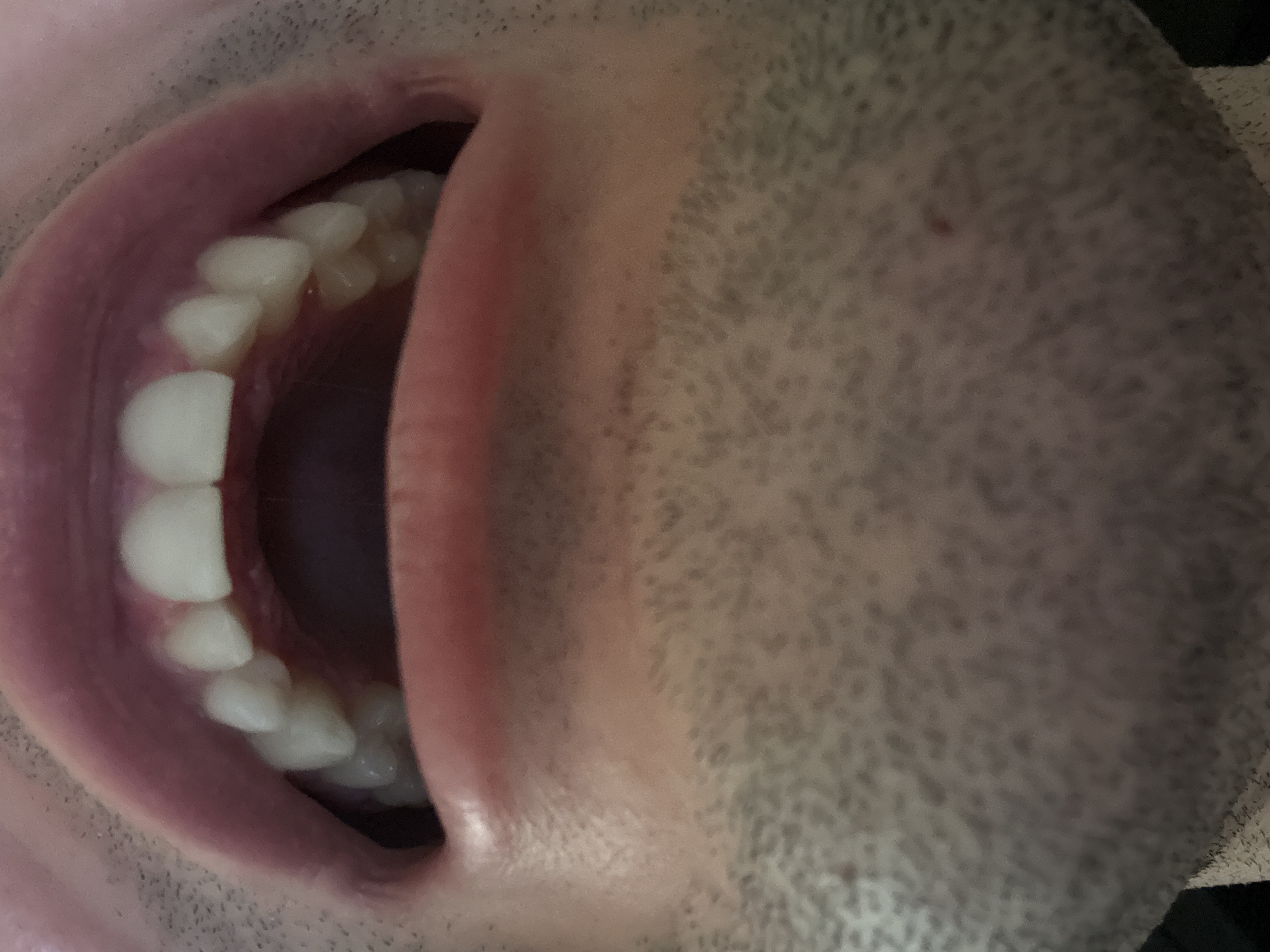 mouth upper arch mouth upper arch