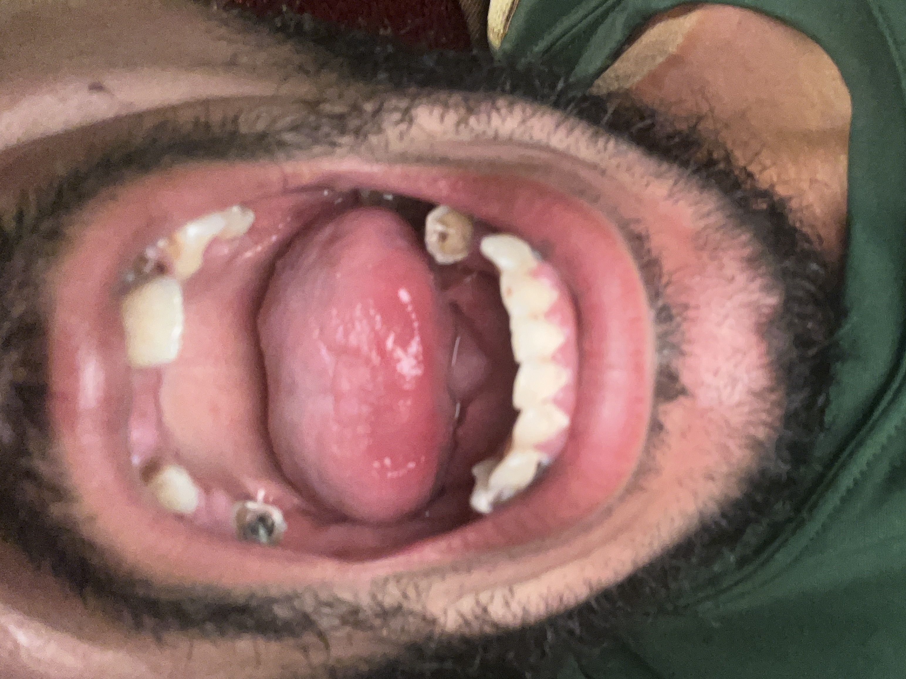 mouth open