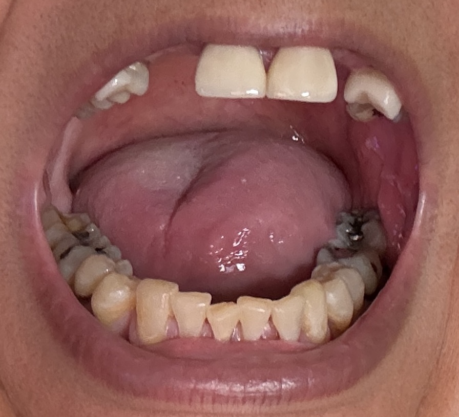 mouth open